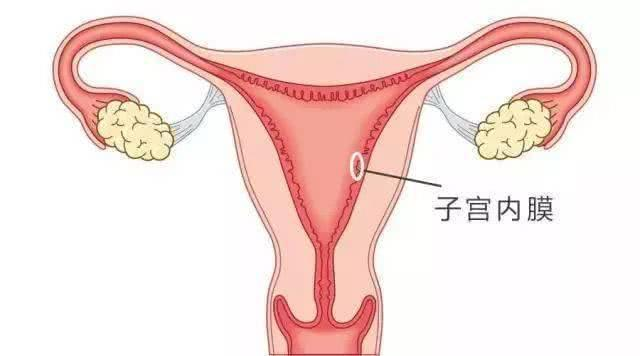 子宫内膜炎症对身体有害。如何保护子宫？