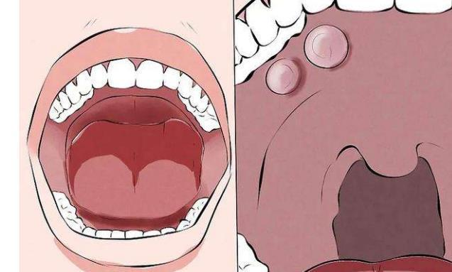 重庆治疗口腔癌中医馆哪家好
