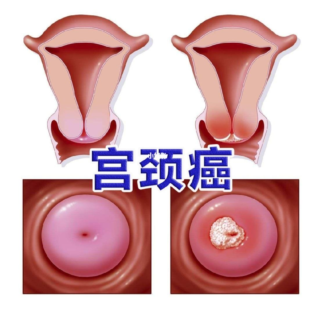重庆市看肿瘤比较好的医馆