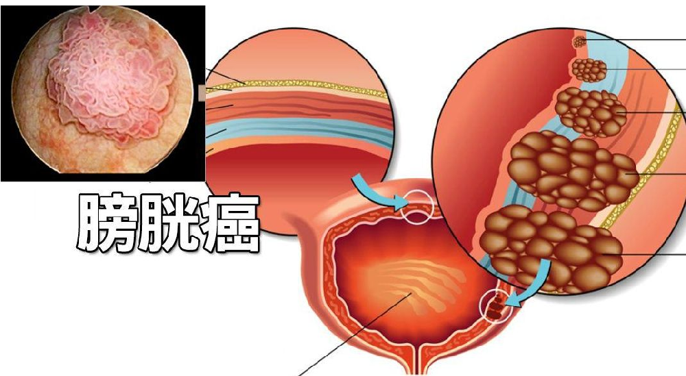重庆比较好的肿瘤科医馆