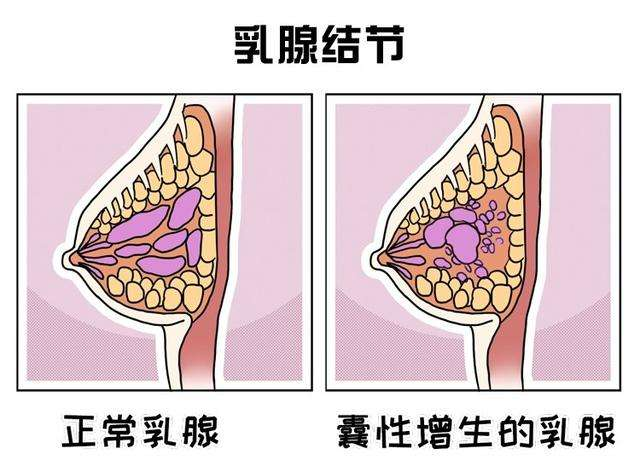 重庆市看结节病厉害的中医专家