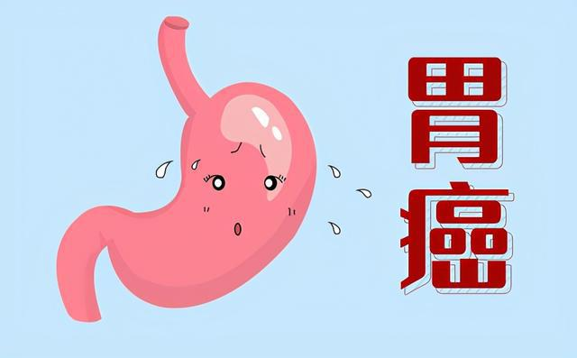 肿瘤医师罗登祥:为什么会得胃癌？实际上是幽门螺杆菌感染！