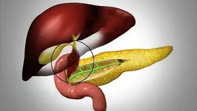 胰腺癌到底有多可怕,听听肿瘤医师罗登祥怎么说