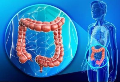 重庆中医肿瘤医师:结肠癌要怎么防,这6种食物可预防结肠癌