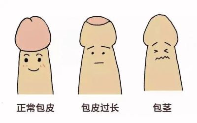 重庆肿瘤中医馆科普|阴茎有硬结需检查是不是阴茎癌