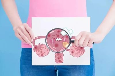 重庆肿瘤老中医罗登祥:外阴癌和阴道炎应该如何辨别