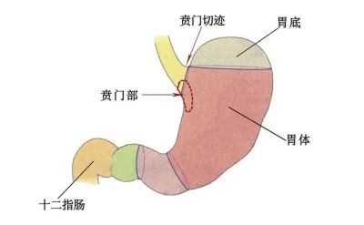 重庆治疗贲门癌老中医:贲门癌的中医治疗方法有哪些？
