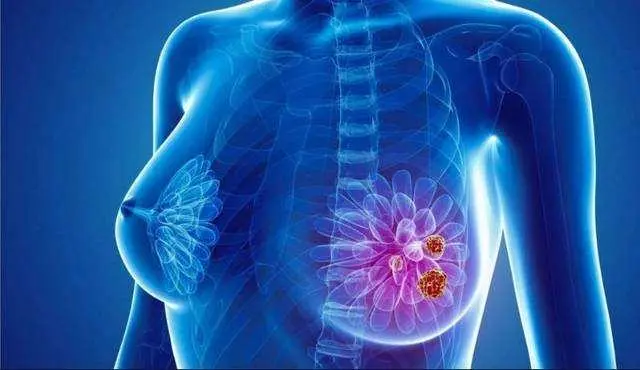 重庆中医肿瘤科医院科普|乳腺癌患者的情志调摄