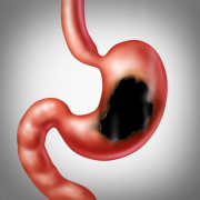 胃炎患者这四种食物不要吃，听听重庆御和堂中医怎么说