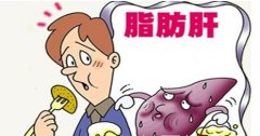 脂肪肝怎么治,脂肪肝的饮食疗法