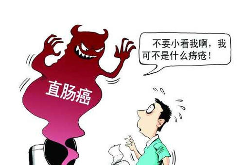 直肠癌的表现有哪些