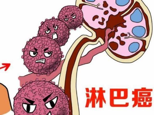 中药如何调理淋巴癌？中医治疗淋巴癌效果好吗？